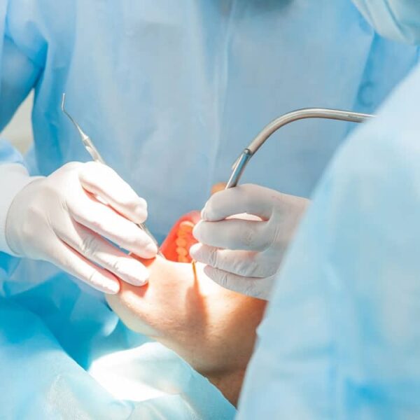 Prepare for Oral Surgery